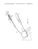 SUTURING, CRIMPING AND CUTTING DEVICE diagram and image