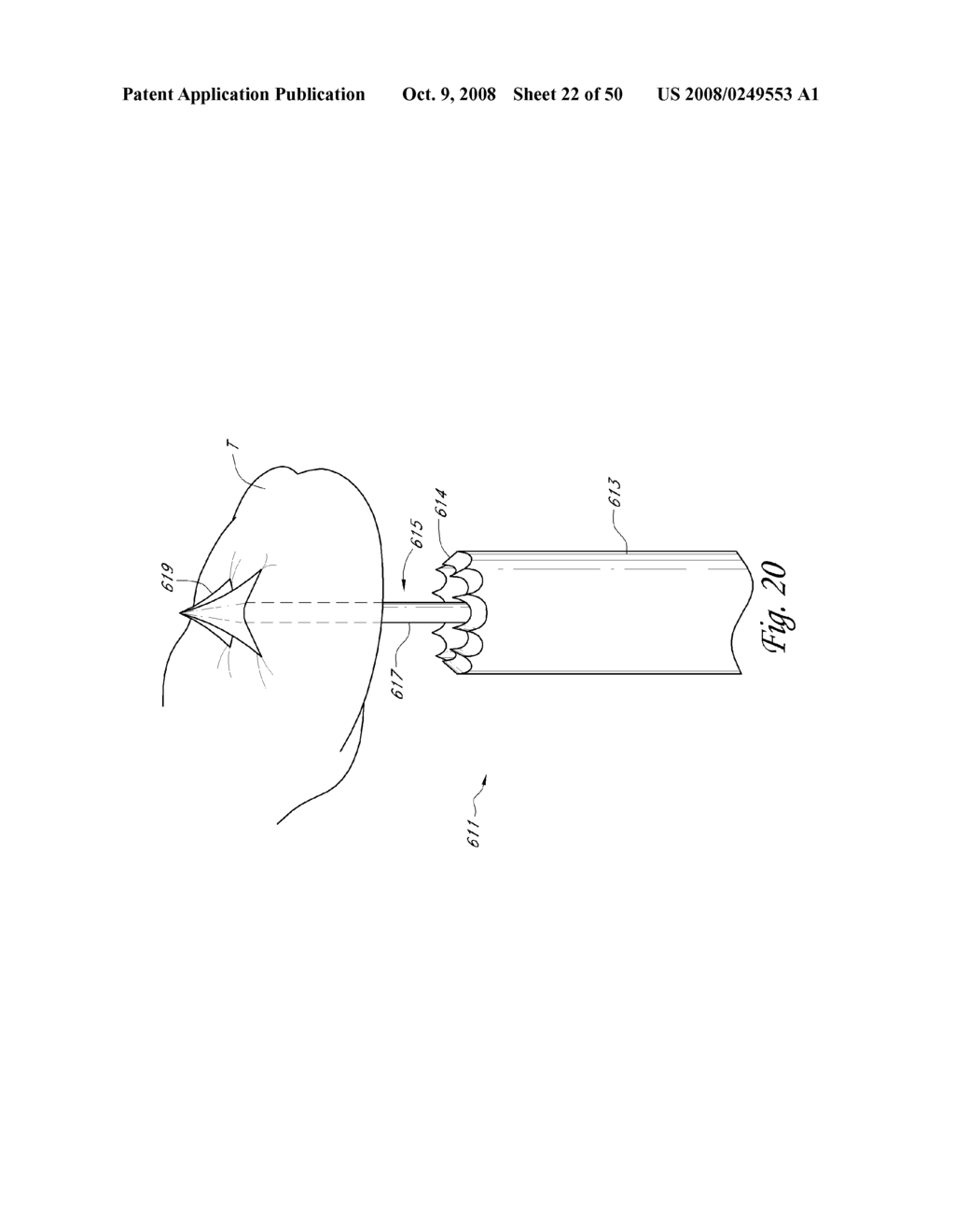 METHOD, SYSTEM AND DEVICE FOR TISSUE REMOVAL - diagram, schematic, and image 23