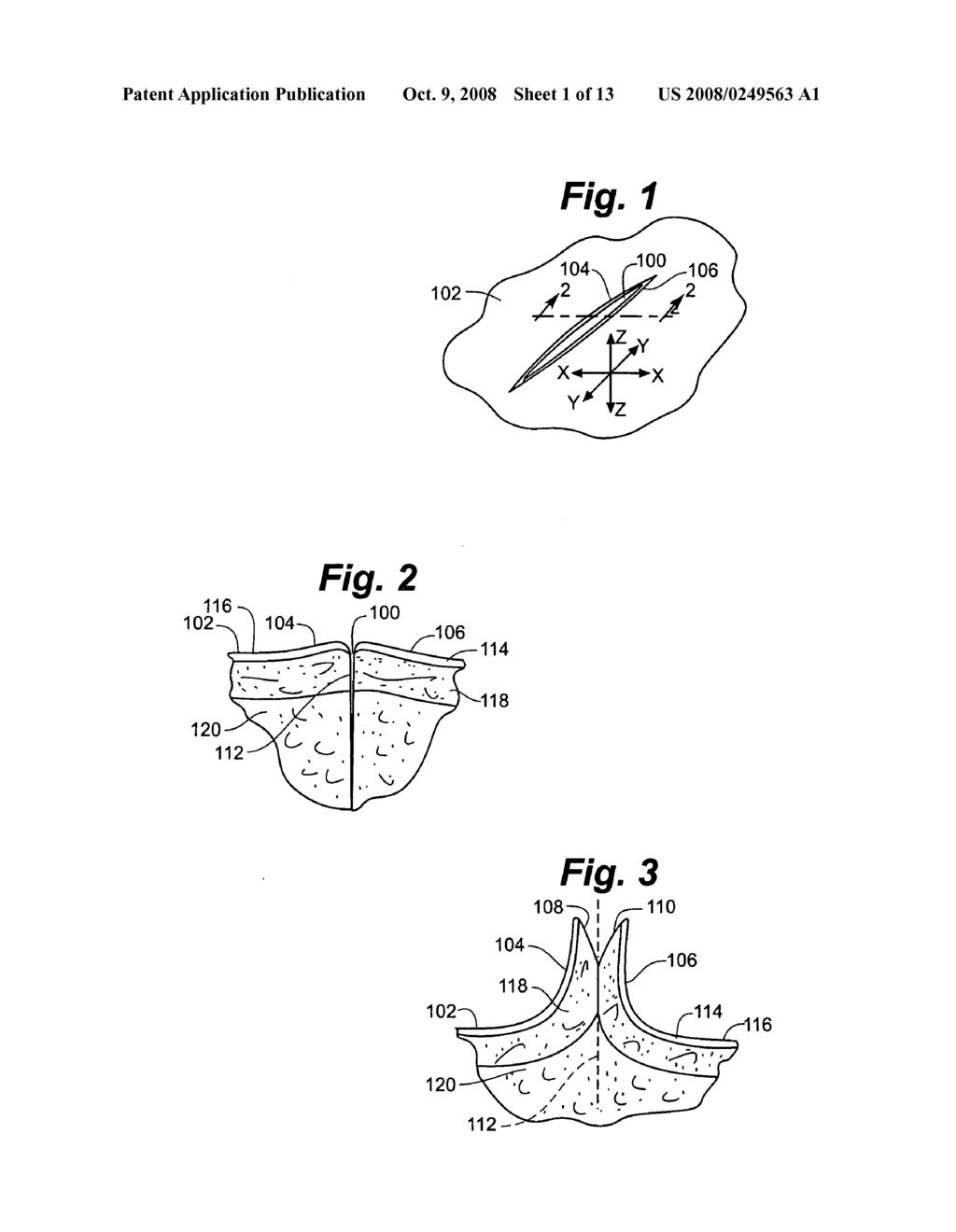 Method and apparatus for tissue fastening - diagram, schematic, and image 02