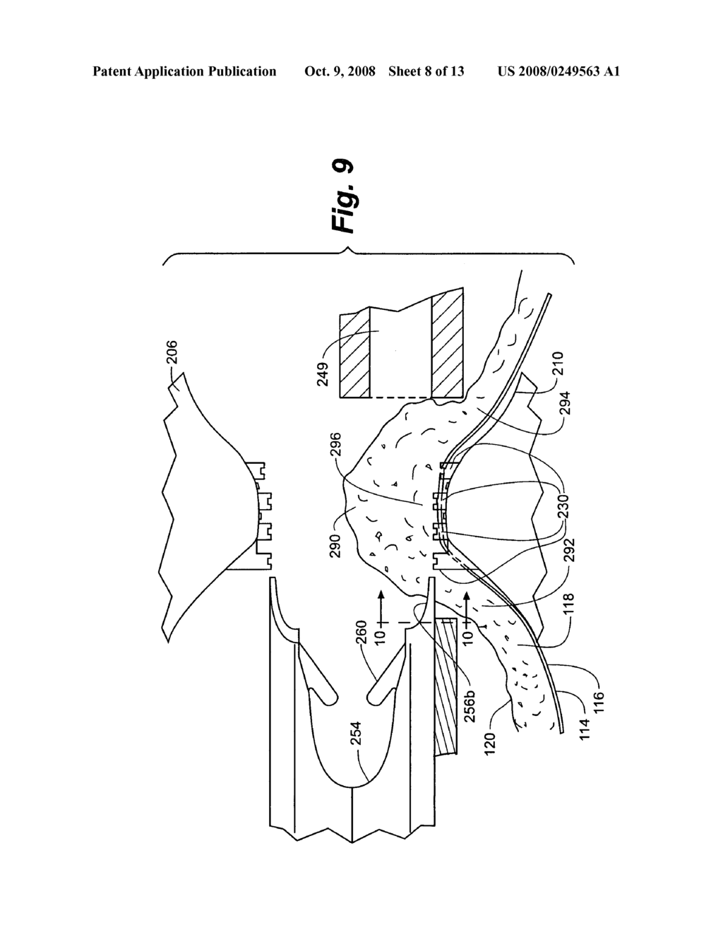 Method and apparatus for tissue fastening - diagram, schematic, and image 09
