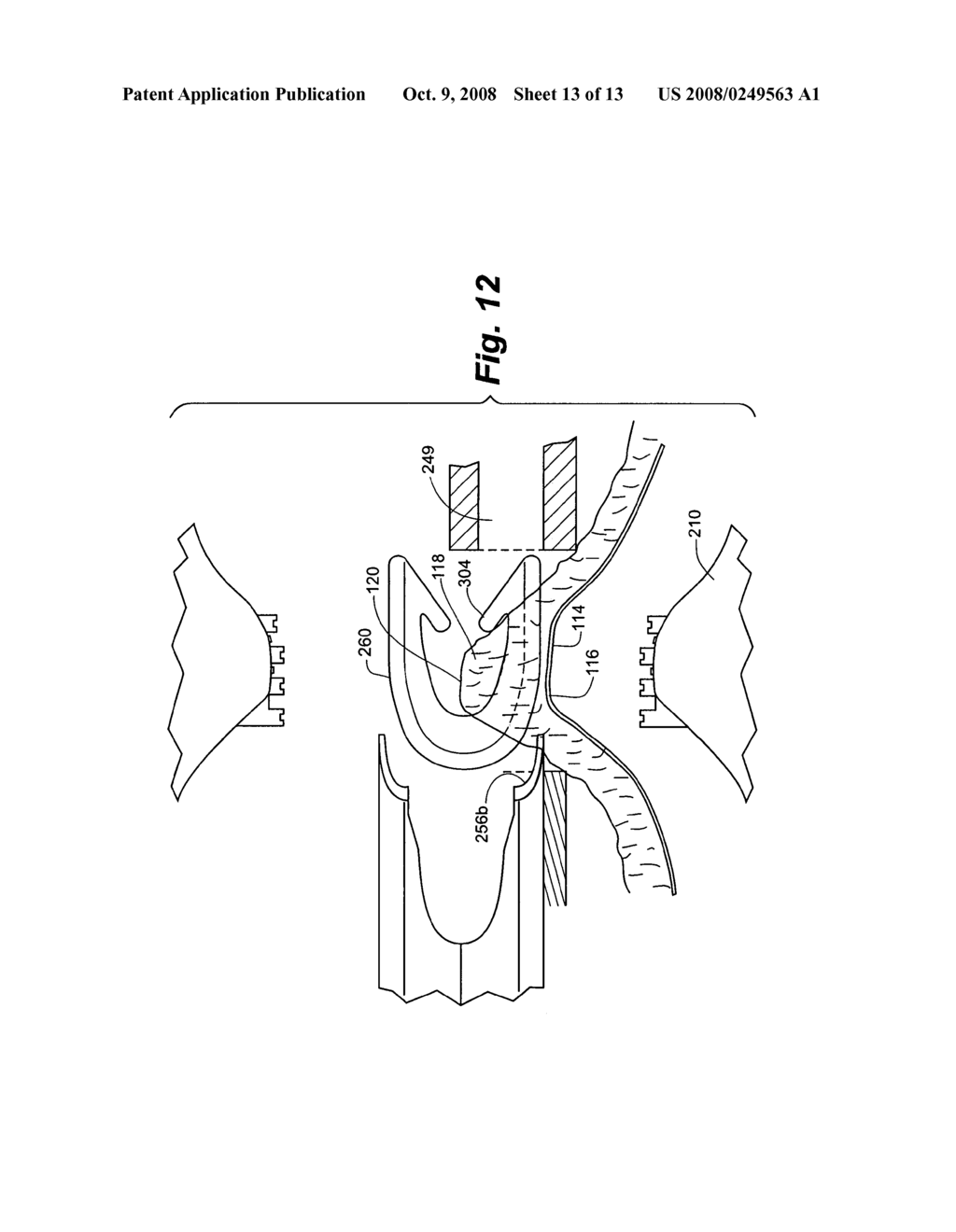 Method and apparatus for tissue fastening - diagram, schematic, and image 14