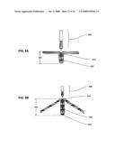 METHODS AND DEVICES FOR REDUCING GASTRIC VOLUME diagram and image