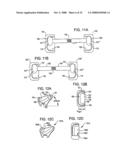 Crossbar Spinal Prosthesis Having a Modular Design and Systems for Treating Spinal Pathologies diagram and image