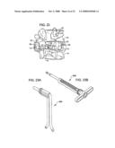 Crossbar Spinal Prosthesis Having a Modular Design and Systems for Treating Spinal Pathologies diagram and image