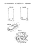 Crossbar Spinal Prosthesis Having a Modular Design and Systems for Treating Spinal Pathologies diagram and image