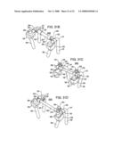 Crossbar Spinal Prosthesis Having a Modular Design and Systems for Treating Spinal Pathologies diagram and image