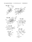 Crossbar Spinal Prosthesis Having a Modular Design and Systems for Treating Spinal Pathologies diagram and image