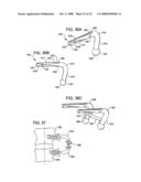 Crossbar Spinal Prosthesis Having a Modular Design and Systems for Treating Spinal Pathologies diagram and image