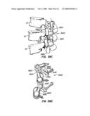 Crossbar Spinal Prosthesis Having a Modular Design and Systems for Treating Spinal Pathologies diagram and image