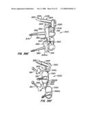 Crossbar Spinal Prosthesis Having a Modular Design and Systems for Treating Spinal Pathologies diagram and image