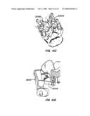 Crossbar Spinal Prosthesis Having a Modular Design and Systems for Treating Spinal Pathologies diagram and image