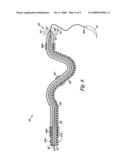 MYOCARDIAL LEAD WITH FIXATION MECHANISM diagram and image