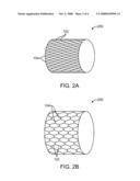 Stent With Therapeutic Agent Delivery Structures in Low Strain Regions diagram and image