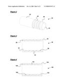 Ventilation Tubes diagram and image