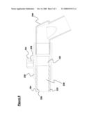 Ventilation Tubes diagram and image