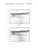 Method for prediction of surface related multiples from marine towed dual sensor seismic streamer data diagram and image