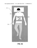 Compton scattered x-ray visualizing, imaging, or information providing of at least some dissimilar matter diagram and image