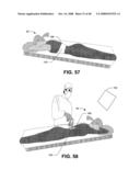 Compton scattered x-ray visualizing, imaging, or information providing of at least some dissimilar matter diagram and image