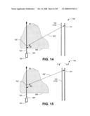 Low invasive technique using compton scattered x-ray visualizing, imaging, or information providing to differentiate at least some dissimilar matter diagram and image