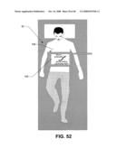 Low invasive technique using compton scattered x-ray visualizing, imaging, or information providing to differentiate at least some dissimilar matter diagram and image