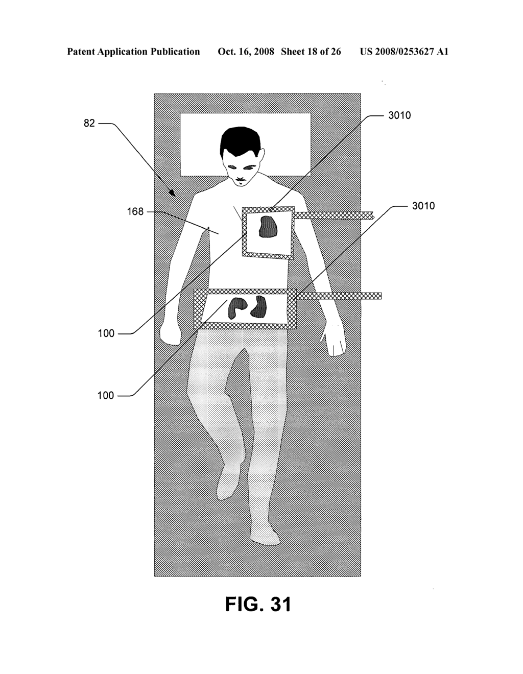 Compton scattered X-ray visualization, imaging, or information provider using image combining - diagram, schematic, and image 19