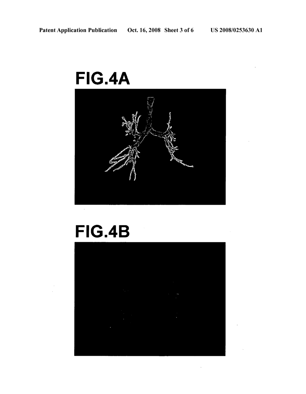 IMAGE DISPLAY METHOD, APPARATUS, AND PROGRAM - diagram, schematic, and image 04