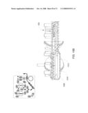 Pumping Cassette diagram and image