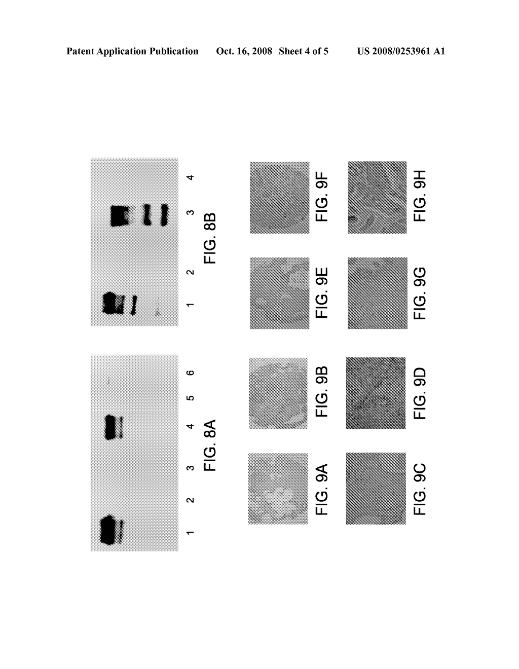 Formulation of Active Agent Loaded Activated PLGA Nanoparticles for Targeted Cancer Nano-Therapeutics - diagram, schematic, and image 05