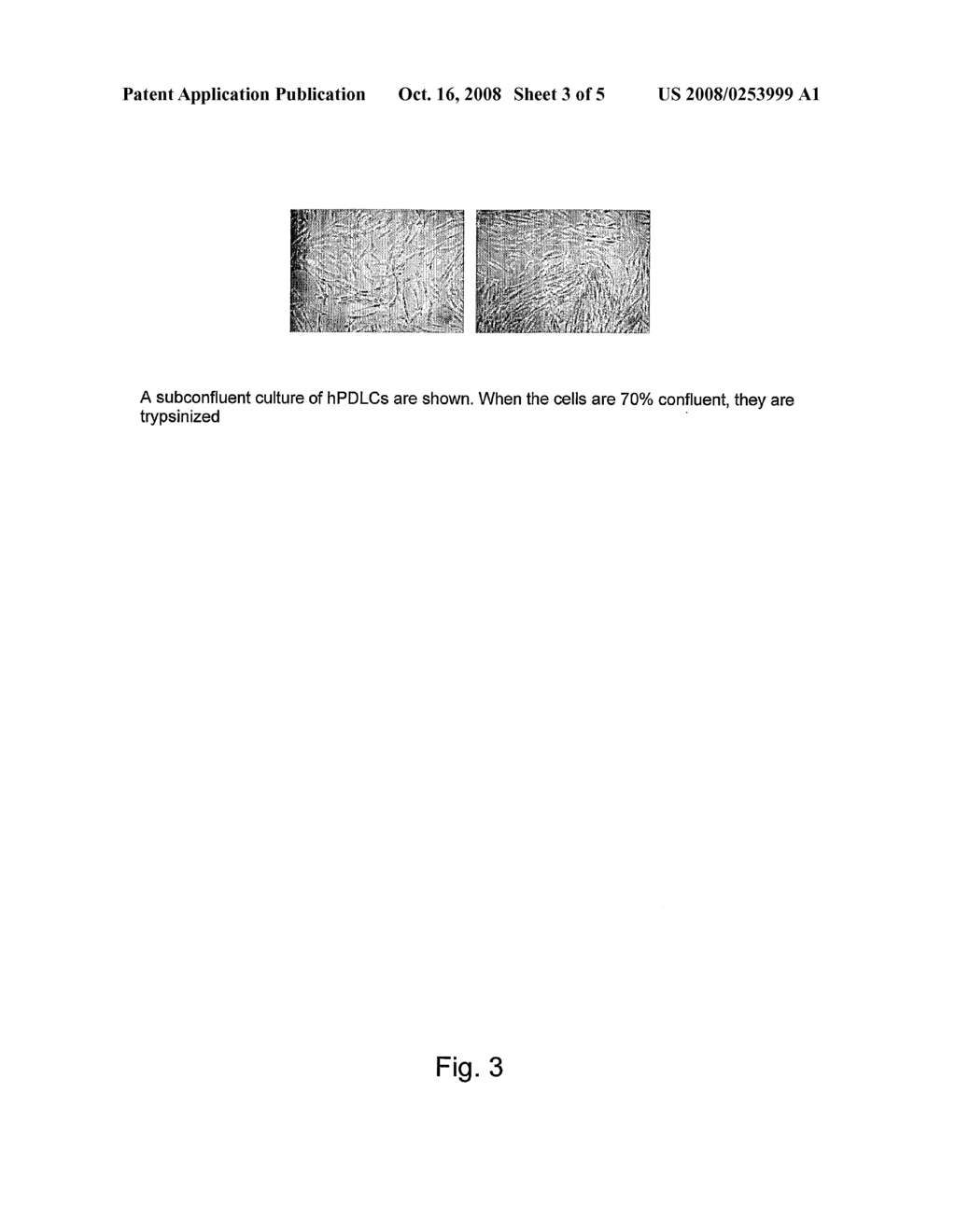 Methods For Differentiating Stem Cells and Uses Thereof in the Treatment of Dental Conditions - diagram, schematic, and image 04