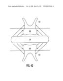 Method and device for improving oral health diagram and image