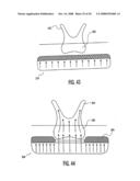 Method and device for improving oral health diagram and image