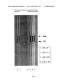 Anti-Sars Virus Antibody, Hybridoma Producing the Antibody and Immunoassay Reagent Using the Antibody diagram and image