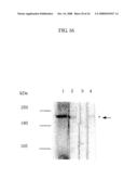 VON WILLEBRAND FACTOR (vWF) - CLEAVING PROTEASE diagram and image