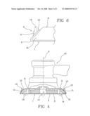 Abrasive Body diagram and image