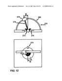 HYBRID IMAGING METHOD TO MONITOR MEDICAL DEVICE DELIVERY AND PATIENT SUPPORT FOR USE IN THE METHOD diagram and image