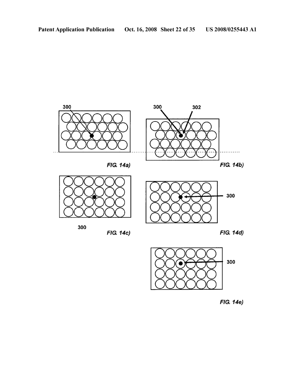 HYBRID IMAGING METHOD TO MONITOR MEDICAL DEVICE DELIVERY AND PATIENT SUPPORT FOR USE IN THE METHOD - diagram, schematic, and image 23