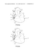 CONTACT SENSOR AND SHEATH EXIT SENSOR diagram and image