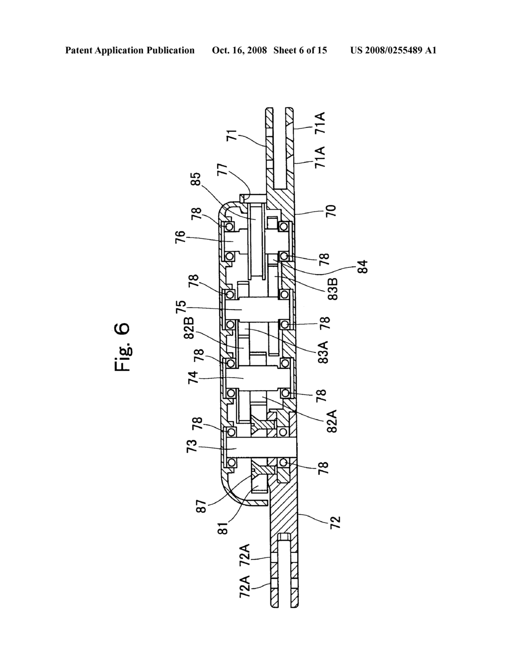 Knee-Ankle-Foot Orthosis with Load Brake - diagram, schematic, and image 07