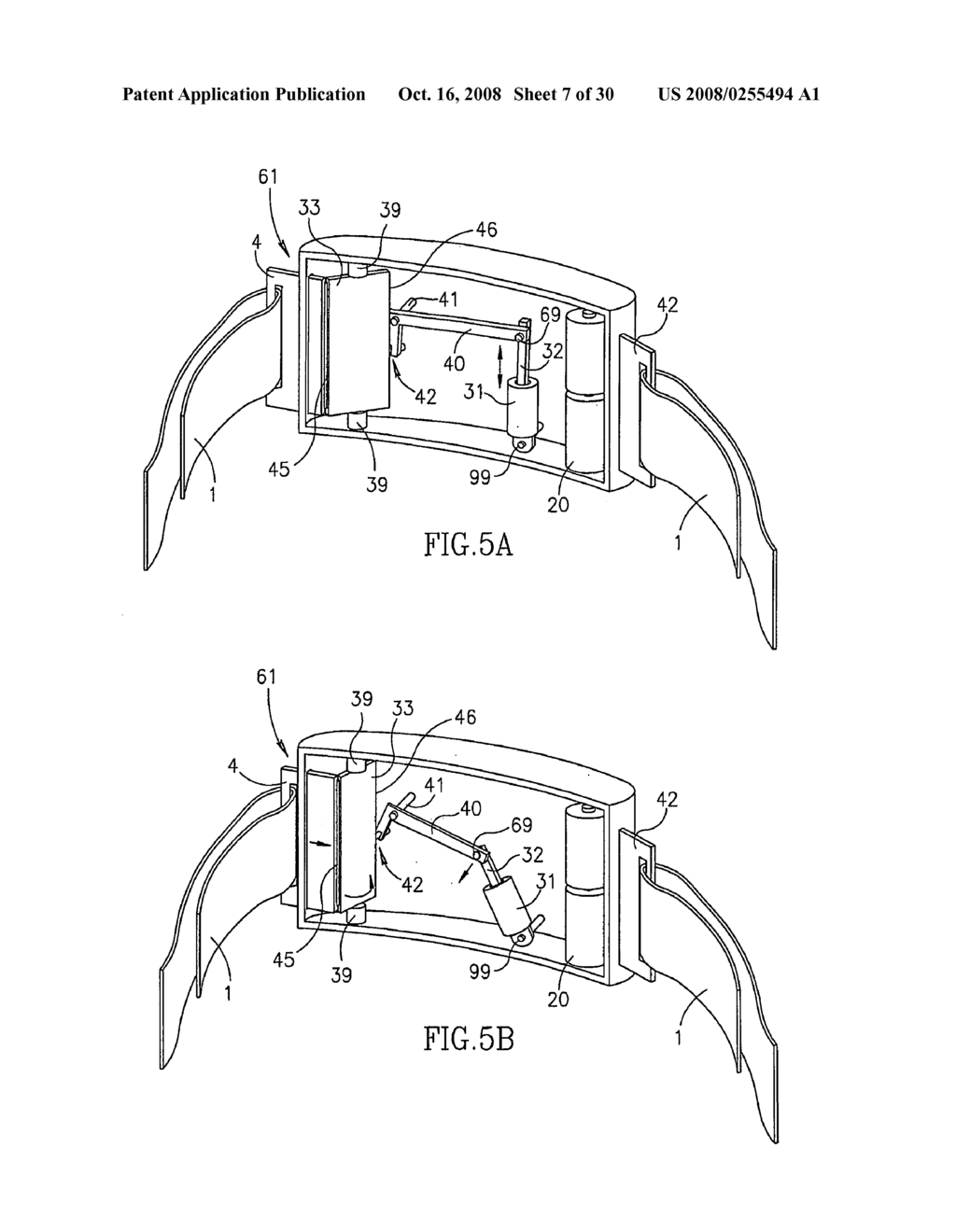 Sleeves for Accommodating a Circulation Enhancement Device - diagram, schematic, and image 08