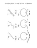 PERCUTANEOUS DELIVERY AND RETRIEVAL SYSTEMS FOR SHAPE-CHANGING ORTHOPEDIC JOINT DEVICES diagram and image