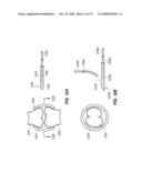 PERCUTANEOUS DELIVERY AND RETRIEVAL SYSTEMS FOR SHAPE-CHANGING ORTHOPEDIC JOINT DEVICES diagram and image