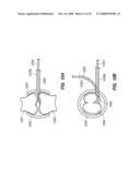 PERCUTANEOUS DELIVERY AND RETRIEVAL SYSTEMS FOR SHAPE-CHANGING ORTHOPEDIC JOINT DEVICES diagram and image