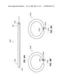 PERCUTANEOUS DELIVERY AND RETRIEVAL SYSTEMS FOR SHAPE-CHANGING ORTHOPEDIC JOINT DEVICES diagram and image