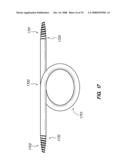 PERCUTANEOUS DELIVERY AND RETRIEVAL SYSTEMS FOR SHAPE-CHANGING ORTHOPEDIC JOINT DEVICES diagram and image