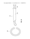 PERCUTANEOUS DELIVERY AND RETRIEVAL SYSTEMS FOR SHAPE-CHANGING ORTHOPEDIC JOINT DEVICES diagram and image