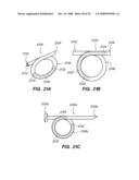 PERCUTANEOUS DELIVERY AND RETRIEVAL SYSTEMS FOR SHAPE-CHANGING ORTHOPEDIC JOINT DEVICES diagram and image