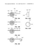 PERCUTANEOUS DELIVERY AND RETRIEVAL SYSTEMS FOR SHAPE-CHANGING ORTHOPEDIC JOINT DEVICES diagram and image