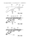 PERCUTANEOUS DELIVERY AND RETRIEVAL SYSTEMS FOR SHAPE-CHANGING ORTHOPEDIC JOINT DEVICES diagram and image