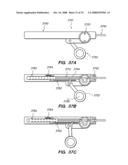 PERCUTANEOUS DELIVERY AND RETRIEVAL SYSTEMS FOR SHAPE-CHANGING ORTHOPEDIC JOINT DEVICES diagram and image