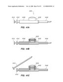 PERCUTANEOUS DELIVERY AND RETRIEVAL SYSTEMS FOR SHAPE-CHANGING ORTHOPEDIC JOINT DEVICES diagram and image